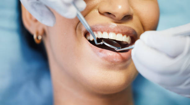 Best Broken or Chipped Tooth Repair in Lavon, TX
