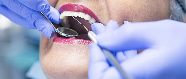 Best Knocked-Out Tooth (Avulsed Tooth) Treatment in Lavon, TX