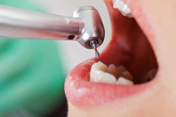Best Emergency Care for Gum Disease in Lavon, TX
